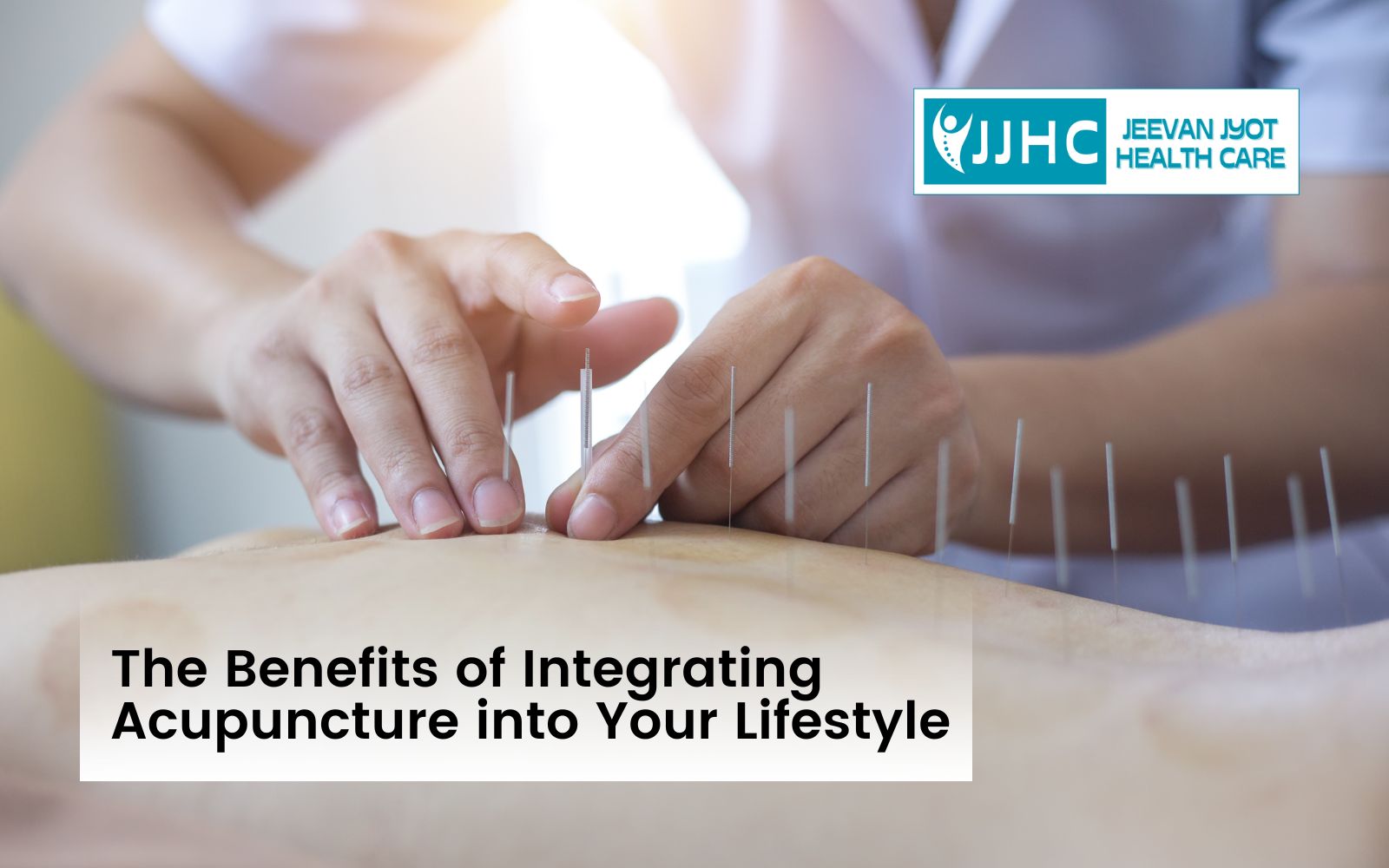 The Benefits of Integrating Acupuncture into Your Lifestyle